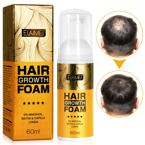 Hair Growth Moisturizing The Scalp And Preventing Hair Loss - Image 5