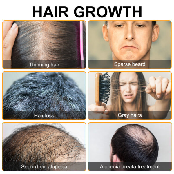 Hair Growth Moisturizing The Scalp And Preventing Hair Loss - Image 4