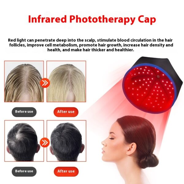 Infrared Phototherapy Cap Red Light Hair Growth Device Pulse Three Gear Adjustment - Image 6
